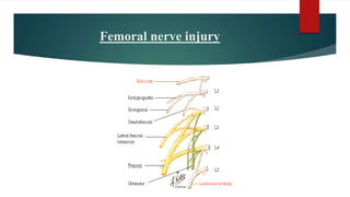 Femoral nerve injury
 