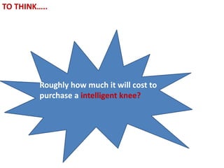 TO THINK…..
Roughly how much it will cost to
purchase a intelligent knee?
 