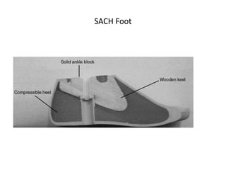 SACH Foot
 