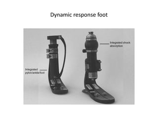 Dynamic response foot
 