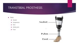 TRANSTIBIAL PROSTHESIS
 Parts
 Socket
 Suspension
 Shin
 Ankle joint
 Foot
 