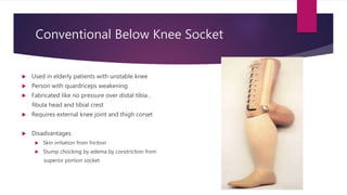 Conventional Below Knee Socket
 Used in elderly patients with unstable knee
 Person with quardriceps weakening
 Fabricated like no pressure over distal tibia ,
fibula head and tibial crest
 Requires external knee joint and thigh corset
 Disadvantages
 Skin irritation from friction
 Stump chocking by edema by constriction from
superior portion socket
 