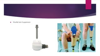  Shuttle lock Suspension
 