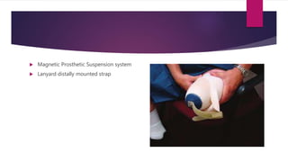  Magnetic Prosthetic Suspension system
 Lanyard distally mounted strap
 