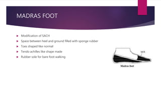 MADRAS FOOT
 Modification of SACH
 Space between heel and ground filled with sponge rubber
 Toes shaped like normal
 Tendo achilles like shape made
 Rubber sole for bare foot walking
 