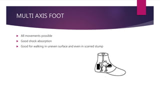 MULTI AXIS FOOT
 All movements possible
 Good shock absorption
 Good for walking in uneven surface and even in scarred stump
 