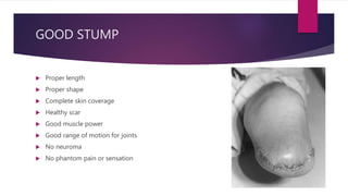 Good Limbs Lower limb prosthesis (hip, knee) | PPTX