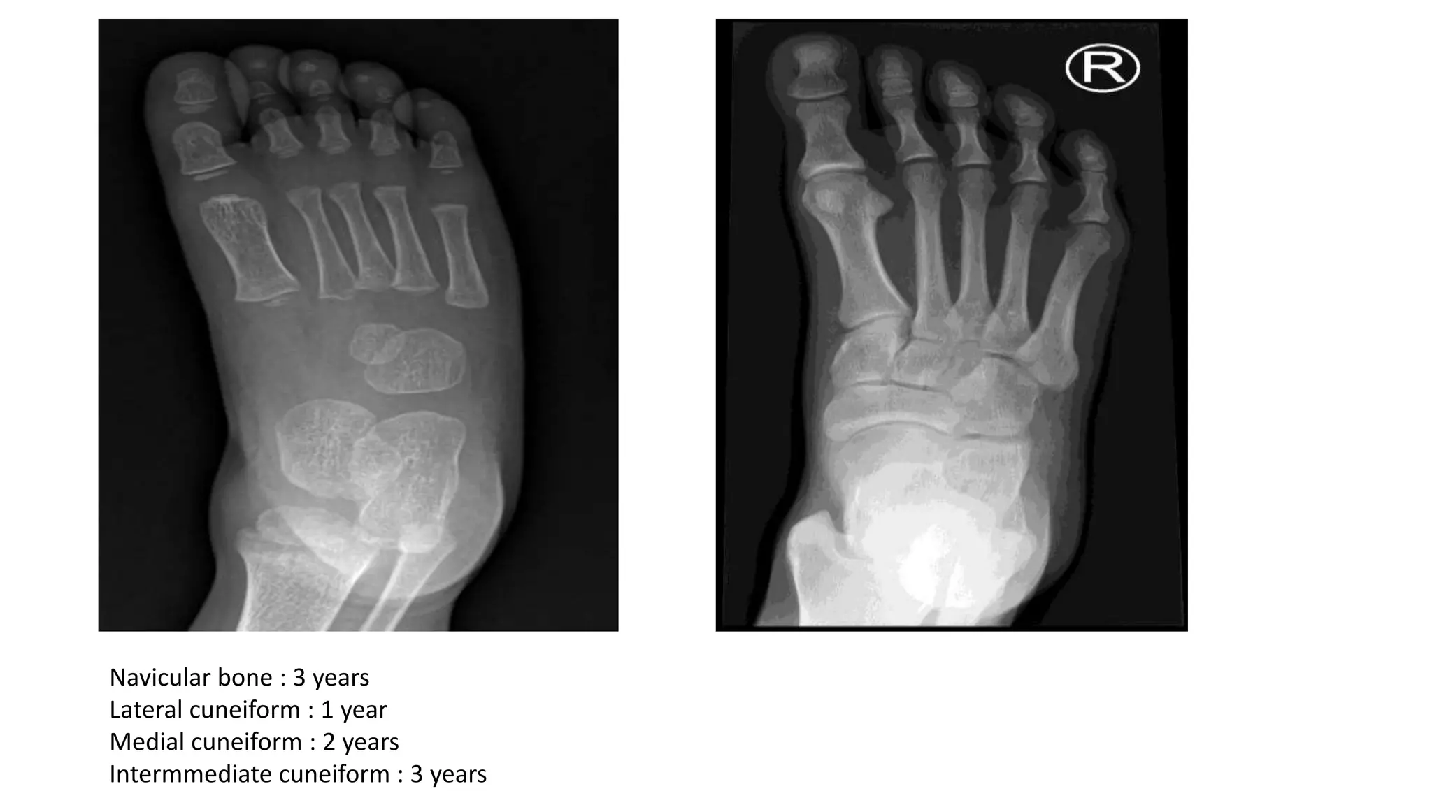 Lower limb radiology | PPTX