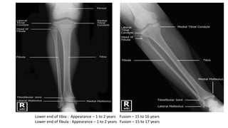 Lower limb radiology | PPTX