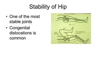 Stability of Hip
• One of the most
stable joints
• Congenital
dislocations is
common
 