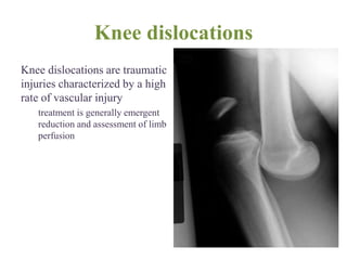 Knee dislocations
Knee dislocations are traumatic
injuries characterized by a high
rate of vascular injury
treatment is generally emergent
reduction and assessment of limb
perfusion
 
