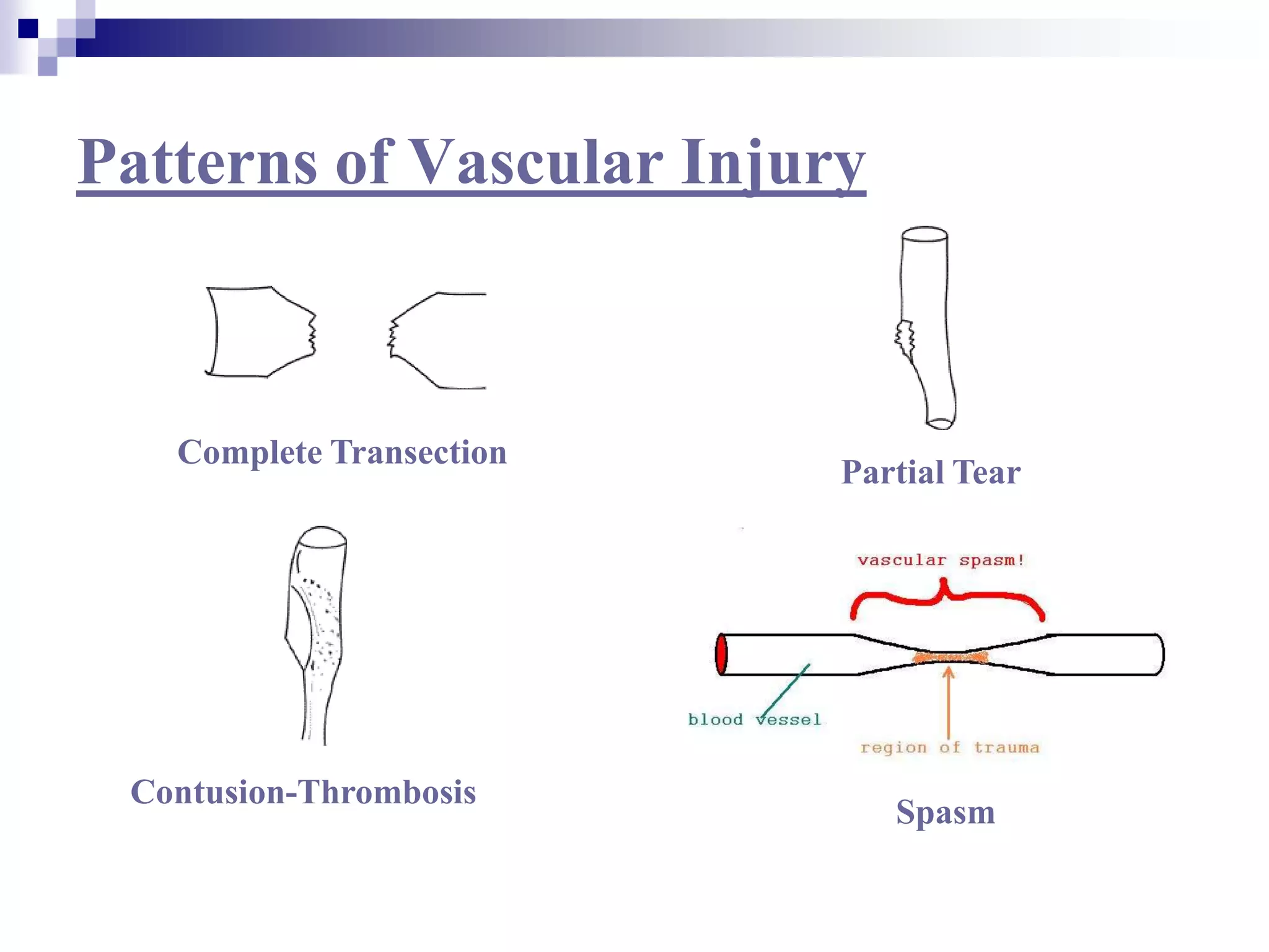 Patterns of Vascular InjuryComplete TransectionPartial TearContusion-ThrombosisSpasm