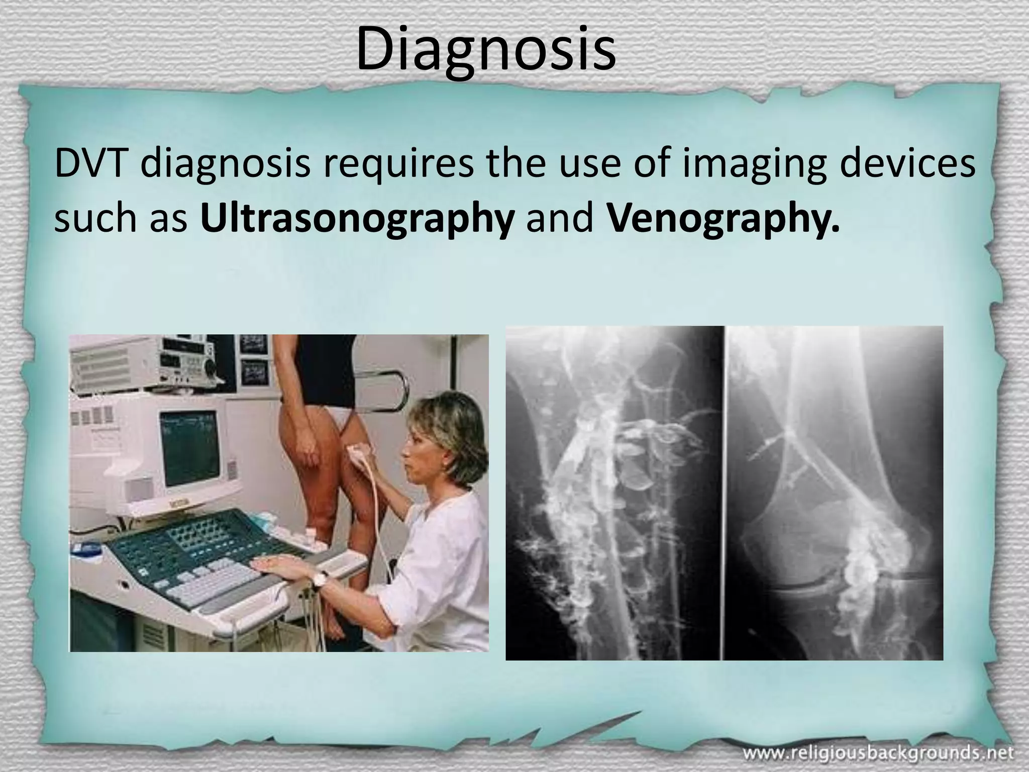 Diagnosis
DVT diagnosis requires the use of imaging devices
such as Ultrasonography and Venography.

 