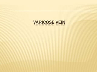 VARICOSE VEIN
 