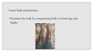 Lower limb examination
◦Examine the bulk by compairaing bulk on both legs and
thighs
 