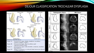 Lower Patellofemoral Instability | PPTX