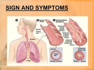 SIGN AND SYMPTOMS
 