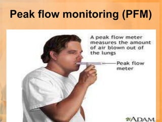 Peak flow monitoring (PFM)
 