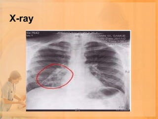 X-ray
 