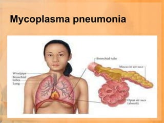 Mycoplasma pneumonia
 