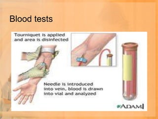 Blood tests
 