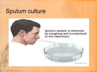 Sputum culture
 