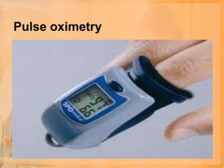 Pulse oximetry
 