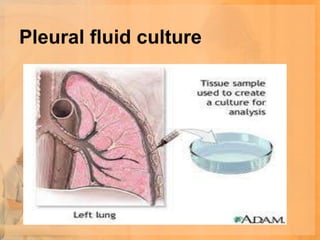 Pleural fluid culture
 