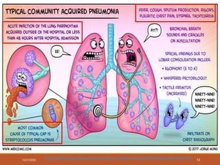 12/21/2022
HTTPS://WWW.KEVINMD.COM/2018/03/LEARN-TYPICAL-COMMUNITY-ACQUIRED-PNEUMONIA-MEDCOMIC.HTML
13
 