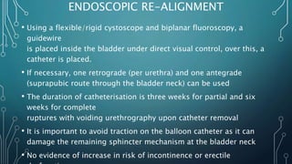 Lower urinary tract trauma | PPTX