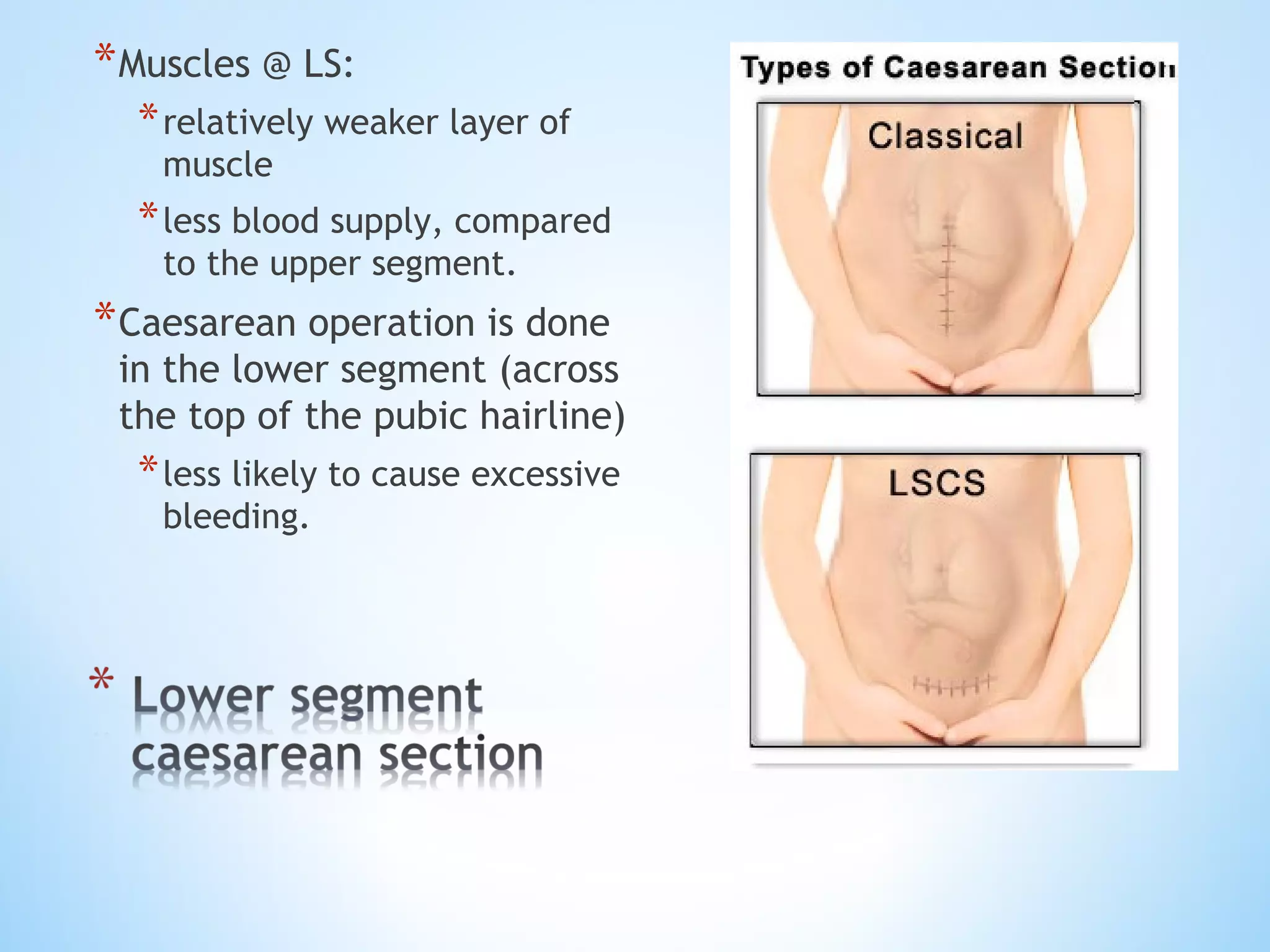 Segment Inferior Lower uterine segment | PPT