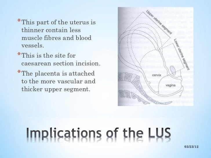 Lower uterine segment