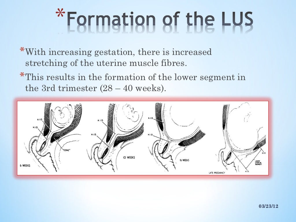 Lower uterine segment