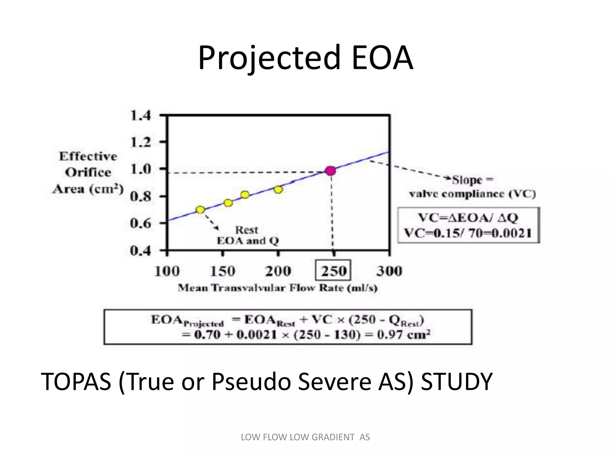 Projected EOA
TOPAS (True or Pseudo Severe AS) STUDY
LOW FLOW LOW GRADIENT AS
 