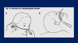 Low flow oxygen therapy.pptx pediatric lecture powerpoint | PPTX