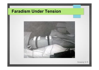 Faradism Under Tension

Sreeraj S R

 