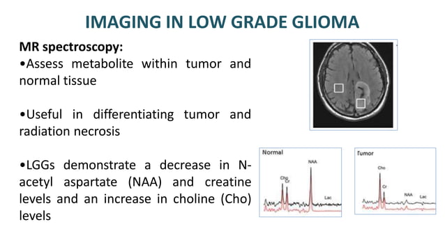 LOW GRADE GLIOMA management in radiotherapy | PPT