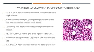 LYMPHOPLASMACYTIC LYMPHOMA-PATHOLOGY
• 1% of all NHLs, with mixed cryoglubulinemia, related with concurrent
Hep C infection
• Mixture of small lymphocytes, lymphoplasmacytic cells and plasma
cells with Russell bodies/ Dutcher bodies are seen
• Occasionally cases may also contain frequent larger immunoblastic-
like cells
• IHC- CD19, CD20, & surface IgM , do not express CD10 or CD23
• Waldenstrom macroglobulinemia (high level of IgM) associated with
LPL
• MYD88 & CXCR4 are associated mutations but are not specific to it
 