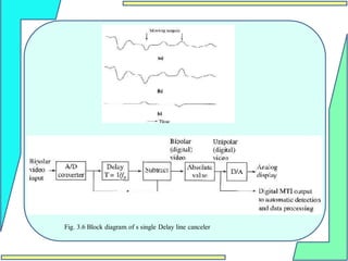 Fig. 3.6 Block diagram of s single Delay line canceler
 