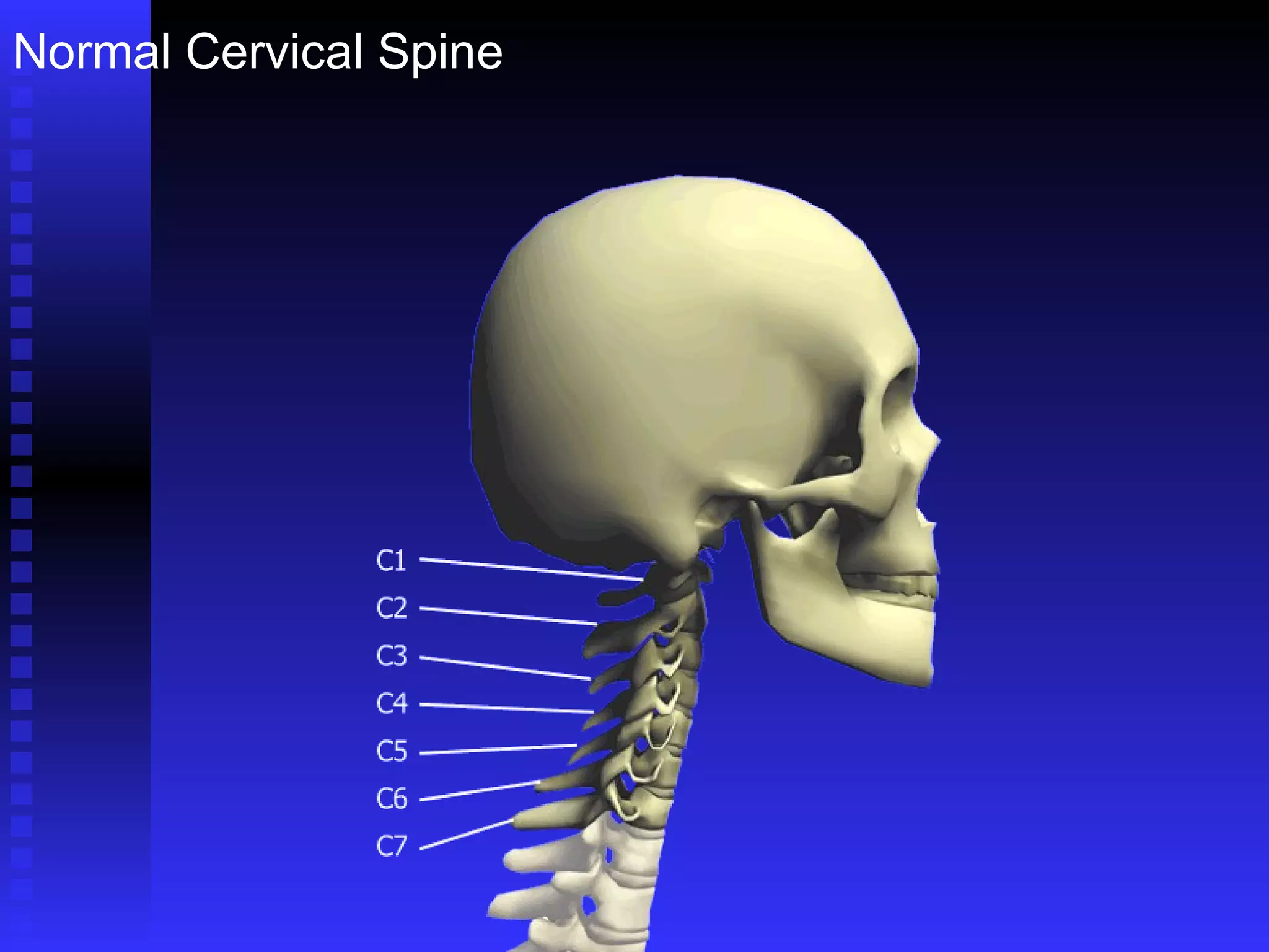 Normal Cervical Spine 