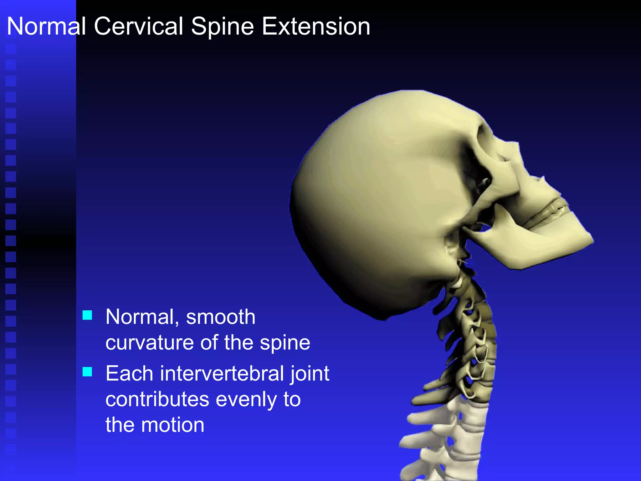 Normal, smooth curvature of the spine Each intervertebral joint contributes evenly to the motion Normal Cervical Spine Extension 
