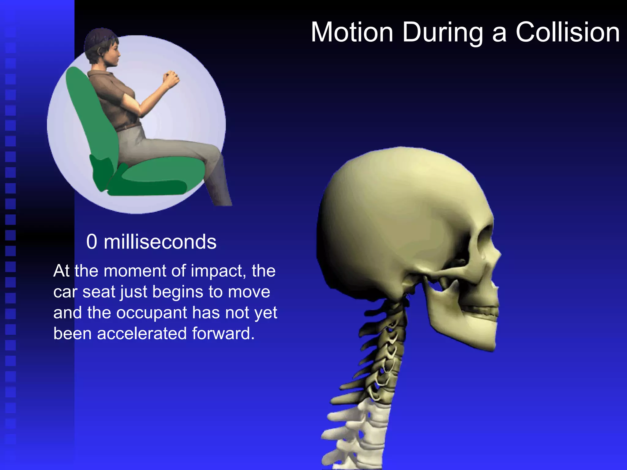 Motion During a Collision 0 milliseconds At the moment of impact, the car seat just begins to move and the occupant has not yet been accelerated forward. 