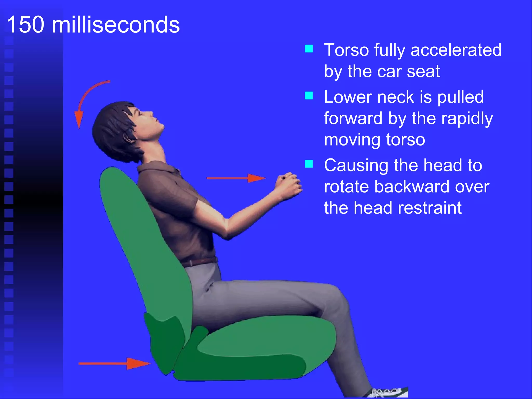 Torso fully accelerated by the car seat Lower neck is pulled forward by the rapidly moving torso Causing the head to rotate backward over the head restraint 150 milliseconds 