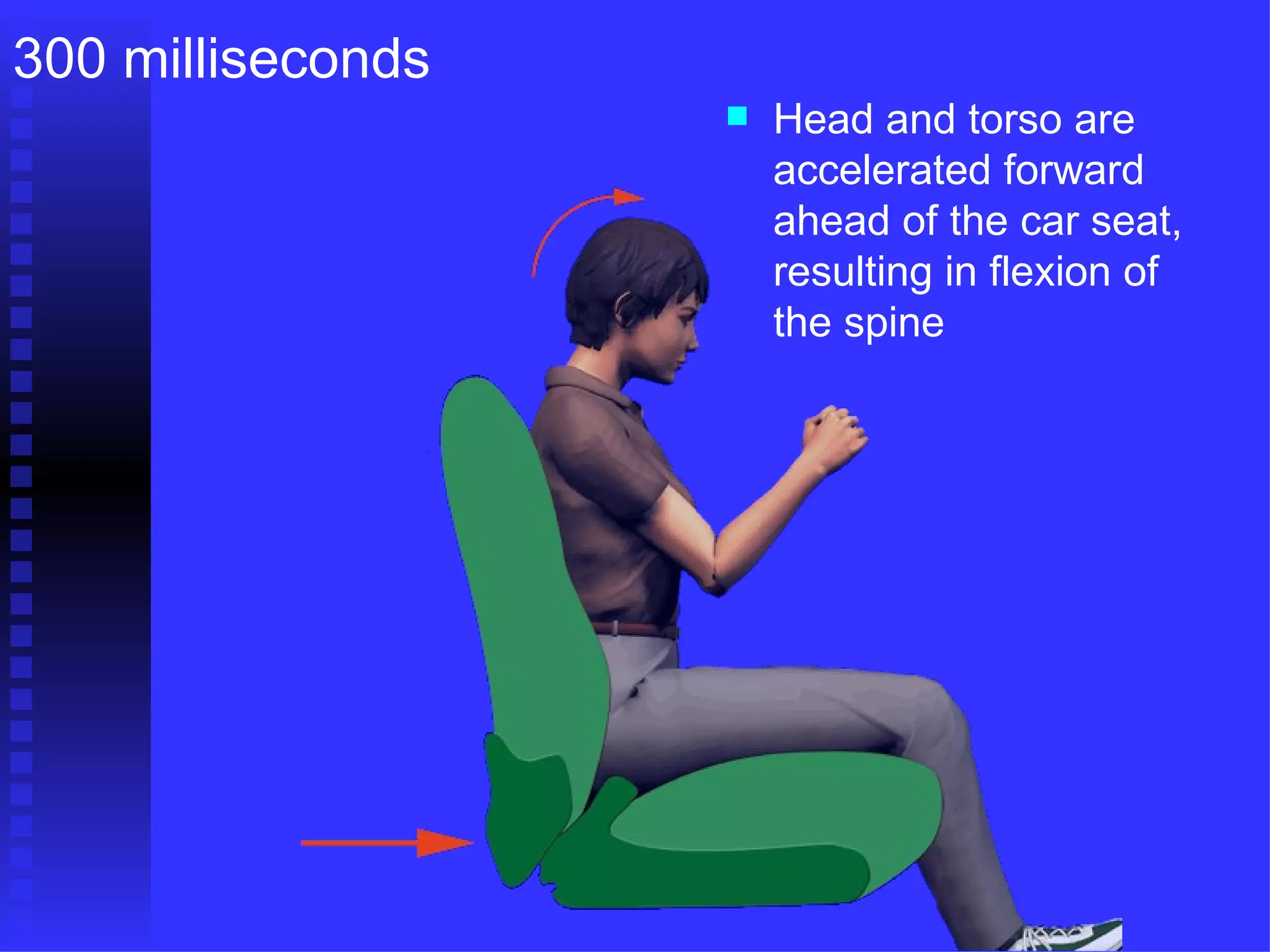 Head and torso are accelerated forward ahead of the car seat, resulting in flexion of the spine 300 milliseconds 