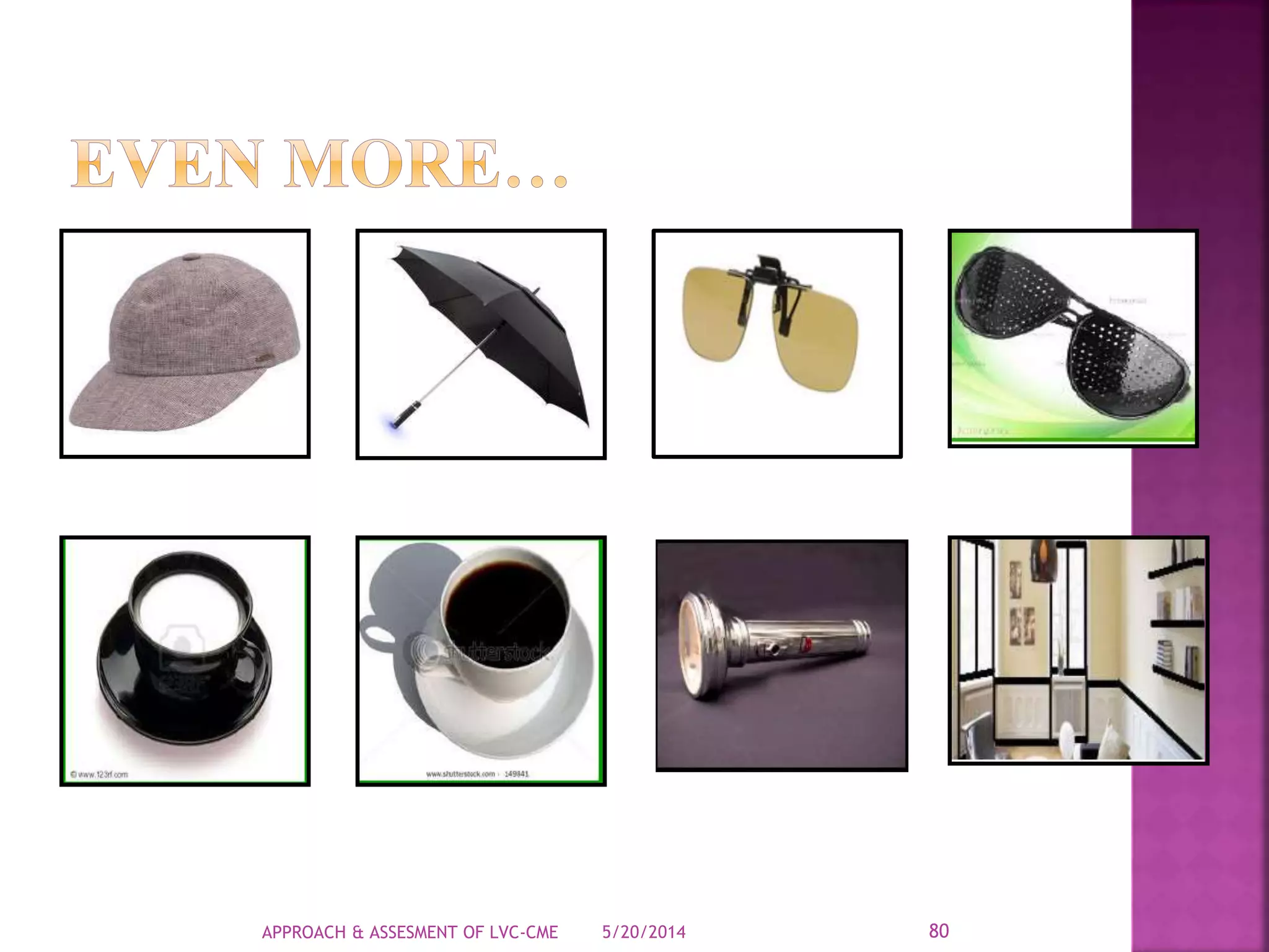 5/20/2014APPROACH & ASSESMENT OF LVC-CME 80
 