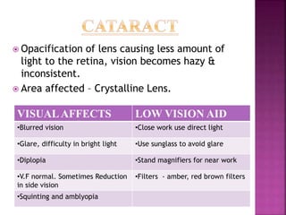  Opacification of lens causing less amount of
light to the retina, vision becomes hazy &
inconsistent.
 Area affected – Crystalline Lens.
VISUALAFFECTS LOW VISION AID
•Blurred vision •Close work use direct light
•Glare, difficulty in bright light •Use sunglass to avoid glare
•Diplopia •Stand magnifiers for near work
•V.F normal. Sometimes Reduction
in side vision
•Filters - amber, red brown filters
•Squinting and amblyopia
 