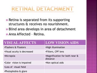  Retina is separated from its supporting
structures & receives no nourishment.
 Blind area develops in area of detachment
 Area Affected – Retina.
VISUALAFFECTS LOW VISION AIDS
•Flashers & Floaters •High illumination
•Visual acuity is decreased •Filters, CPF lens
•Micropsia •Magnification for both near &
distance
•Color vision is impaired •Non optical aids
•Loss of visual field
•Photophobia & glare
 