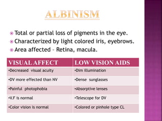  Total or partial loss of pigments in the eye.
 Characterized by light colored iris, eyebrows.
 Area affected – Retina, macula.
VISUALAFFECT LOW VISION AIDS
•Decreased visual acuity •Dim illumination
•DV more effected than NV •Dense sunglasses
•Painful photophobia •Absorptive lenses
•V.F is normal •Telescope for DV
•Color vision is normal •Colored or pinhole type CL
 