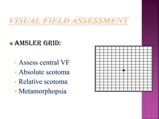 Amsler grid:
• Assess central VF
• Absolute scotoma
• Relative scotoma
• Metamorphopsia
 