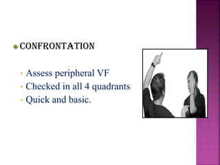 Confrontation
• Assess peripheral VF
• Checked in all 4 quadrants
• Quick and basic.
 